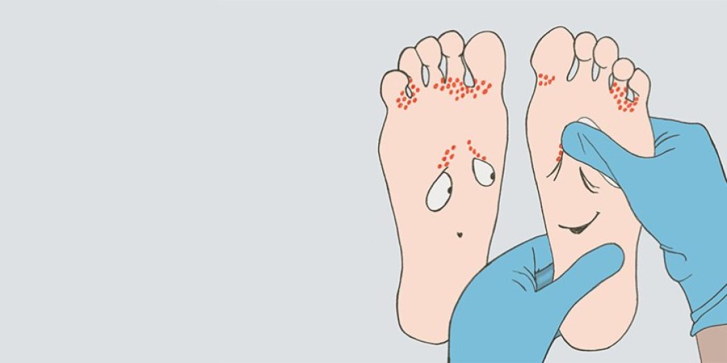Friske og syke føtter